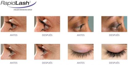 Antes y después Rapidlash