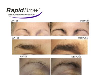 Antes y después Rapid Brow